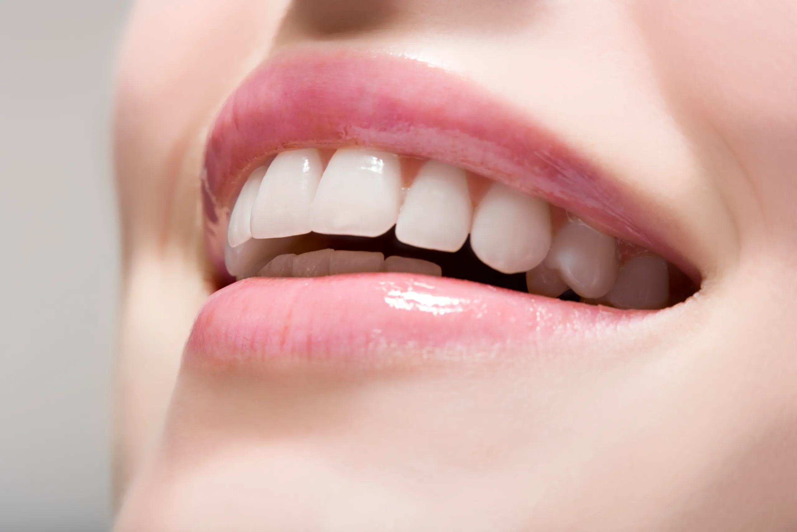 1 Hour Laser Teeth Whitening FAQs Huddersfield