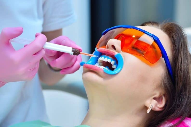 Get a brighter smile in minutes with instant results whitening Huddersfield