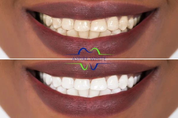 Side-by-side comparison showing before and after results of a cosmetic treatment Huddersfield