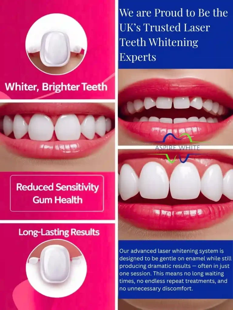 We are Proud to Be the UK’s Trusted Laser Teeth Whitening Experts Huddersfield