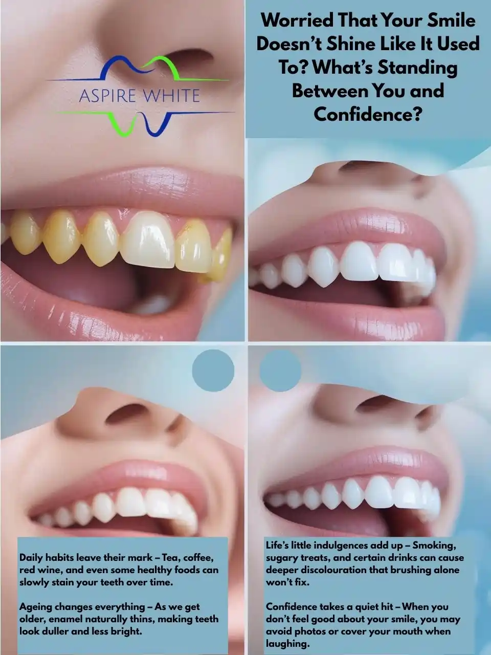 Worried That Your Smile Doesn’t Shine Like It Used To What’s Standing Between You and Confidence Huddersfield